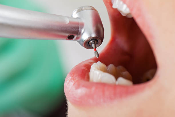 Best Tooth Infection Emergency Dentist  in Marks, MS